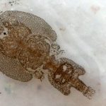 Sea louse under the microscope